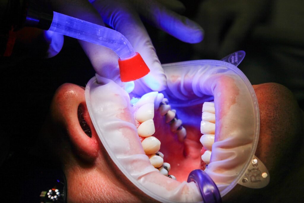 Emergency Dentist in Thindal, Erode: Quick Pain Relief When You Need It