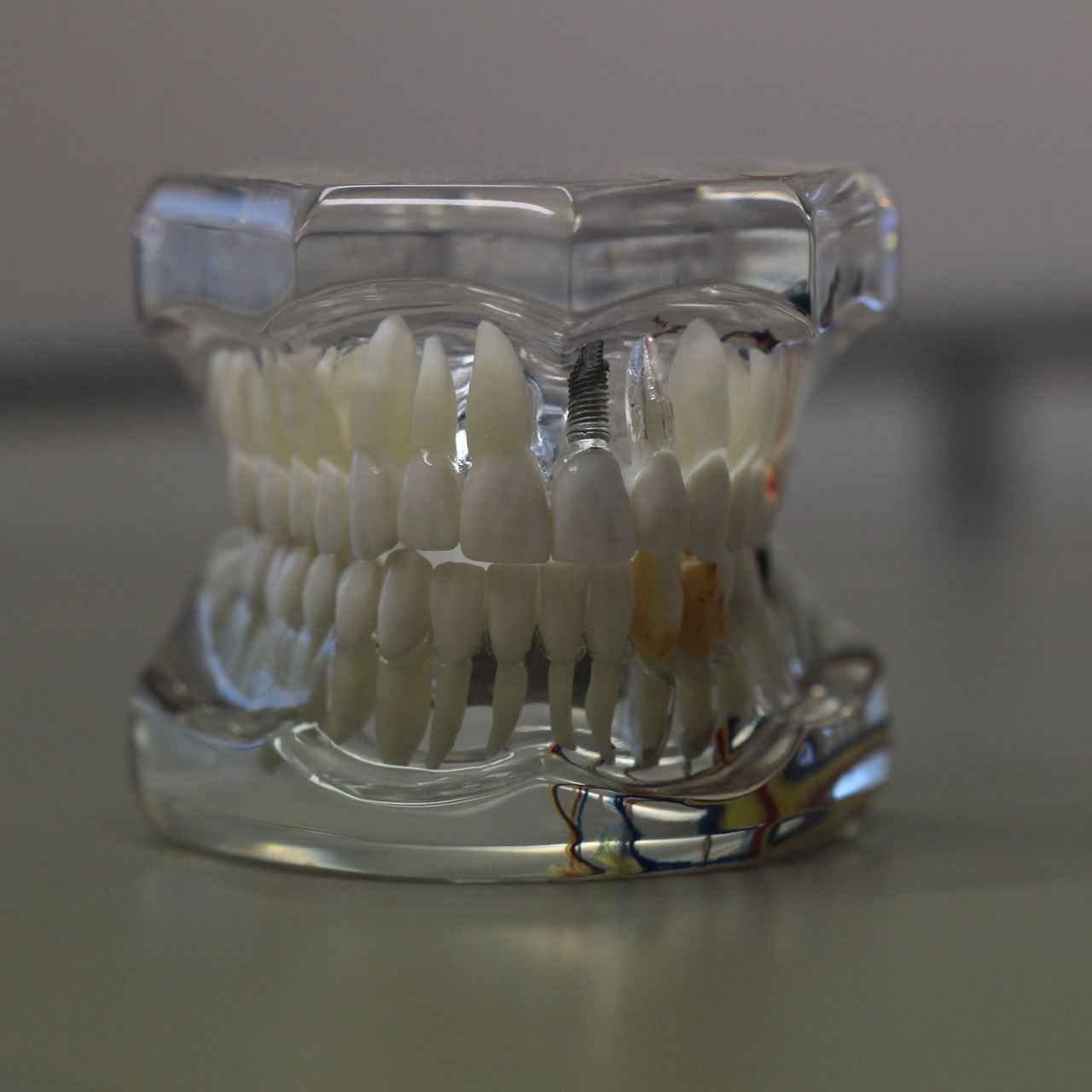 Top Reasons Patients in Thindal Choose Pradeep Dental for Family Care